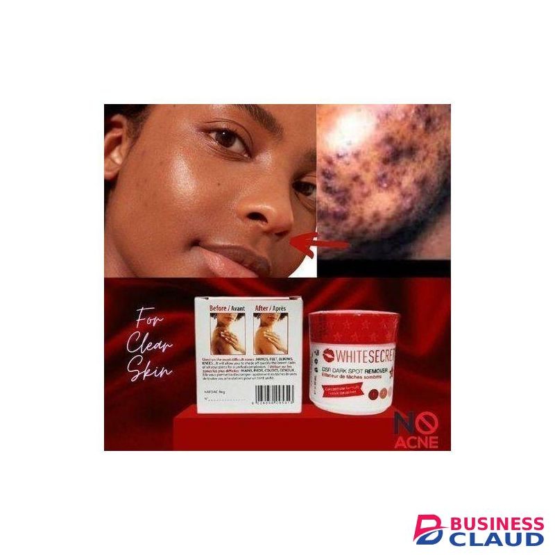 White Secret Dark Spot Remover