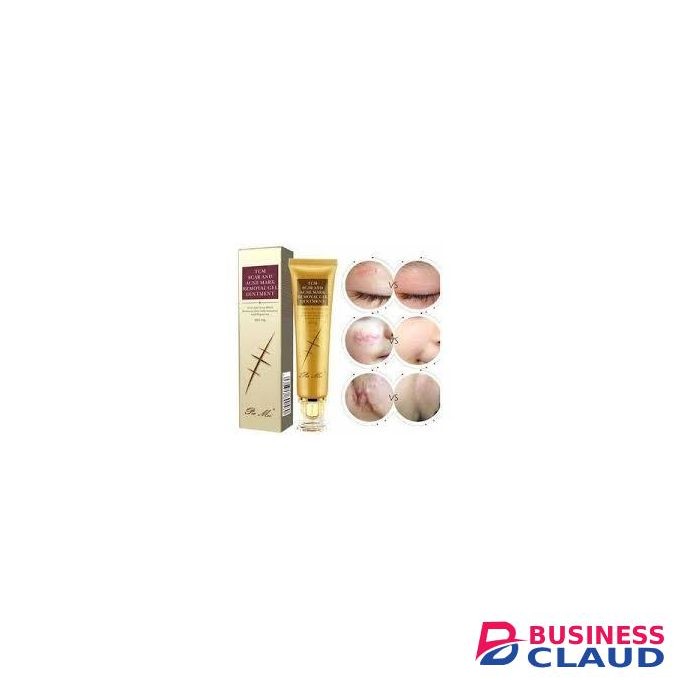 Pei Mei TCM Scar And Acne Mark Removal Gel Ointment