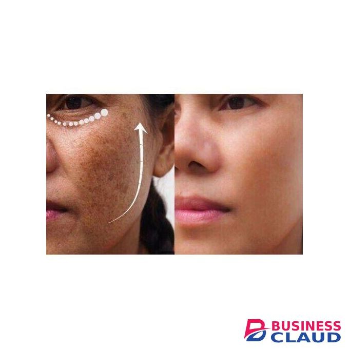 Kojivit Ultra Gel 30g