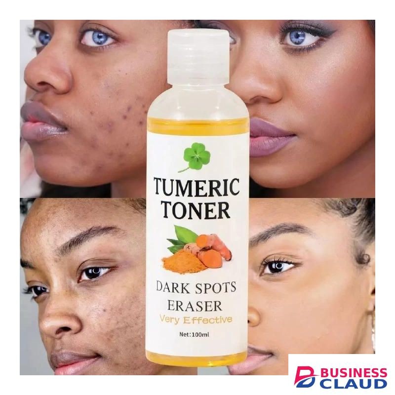 Quick Dark Spots Corrector Serum Tumeric Toner Acne Remover Fade Dark Spots Eraser Skin Care Serum-100ML