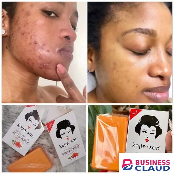 Kojie San Skin Lightening Soap – Original Kojic Acid Whitening Bar – Fades Dark Spots & Brightens Skin (135g)