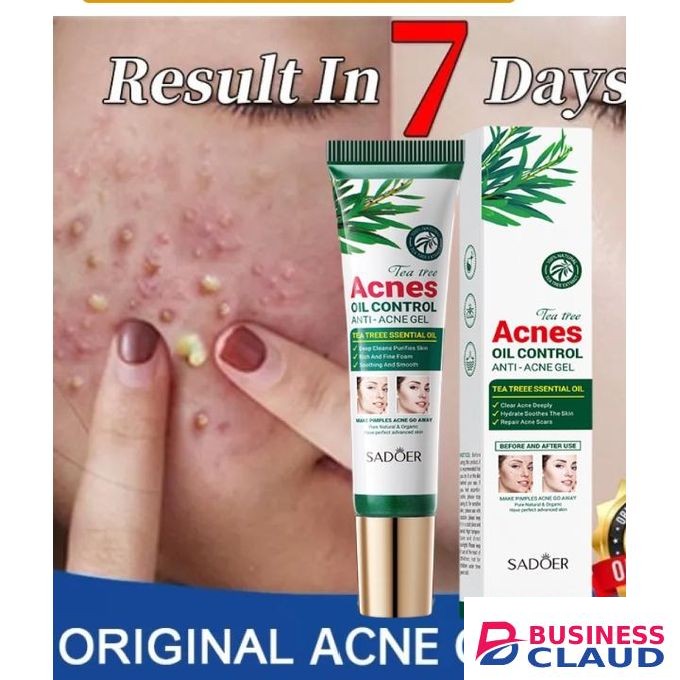 SADOER Tea Tree Anti- Acne Beauty Facial Gel