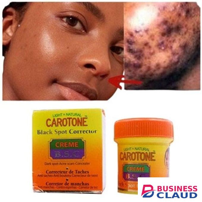 Carotone Light And Natural Black Spot Corrector Acne Scars Concealer - 30mL