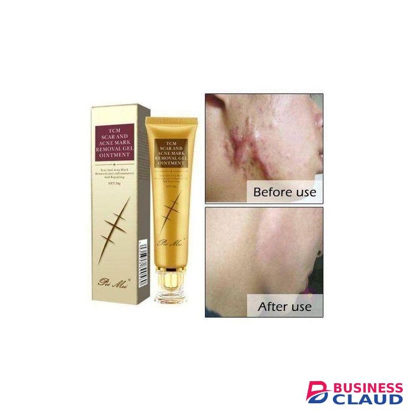 TCM Scar, Acne, Stretch Mark Remover Cream