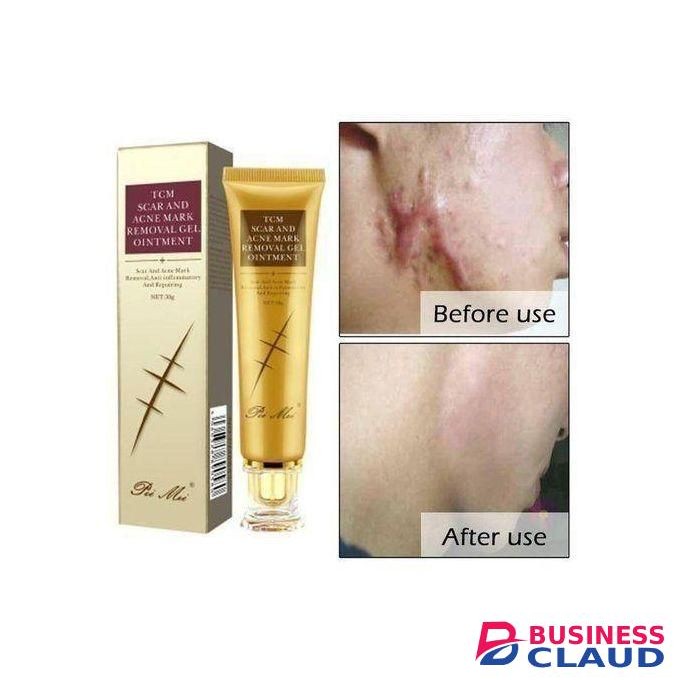 TCM Scar, Acne, Stretch Mark Remover Cream