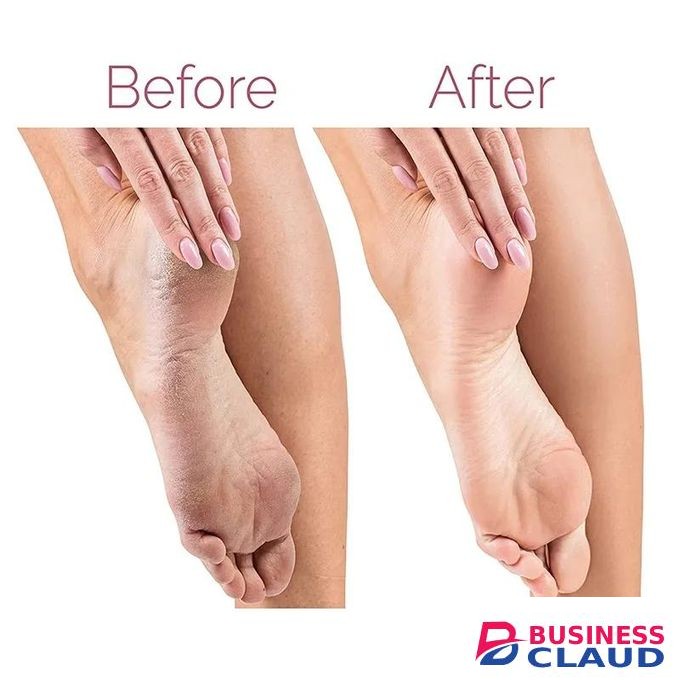 Electric Foot File for Heels Grinding Pedicure Tools Callus Remover USB Rechargeable Professional Foot Care Tool Dead Hard Skin