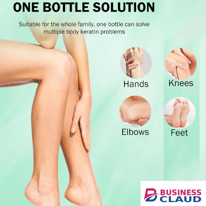MOOYAM Foot Peeling Spray – Dead Skin & Callus Remover, Cracked Heel Repair, Exfoliating & Moisturizing Foot Care for Men & Women