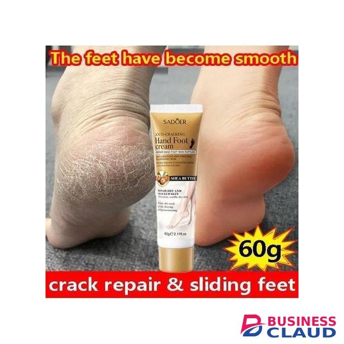 Cracked Foot Repair Cream Anti Crack Foot Cream Cracked Repair Cream Callus Removal Dead Skin Foot Care
