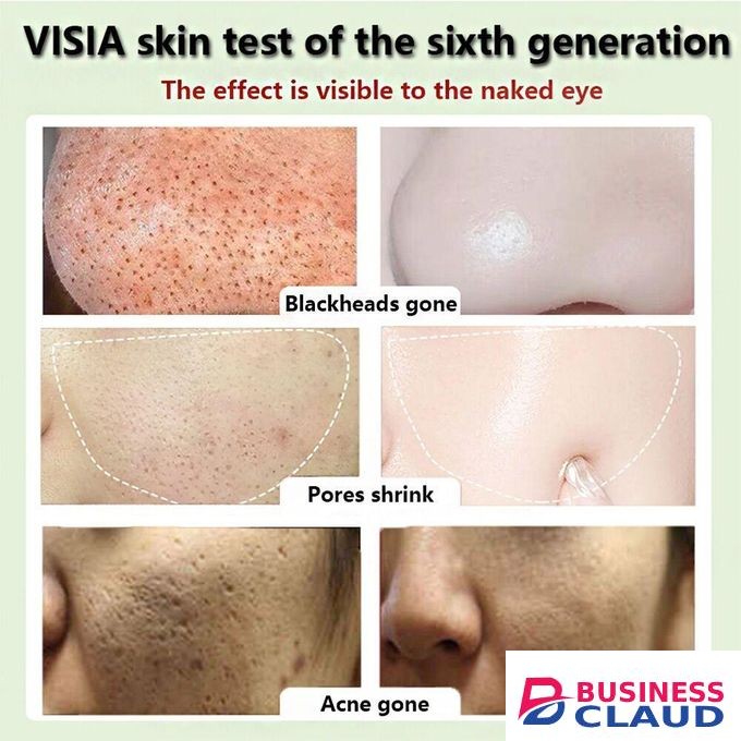Green Mask Stick For Black Spots And Pimples