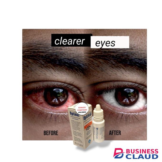 Eye Whitening Eyedrops for Red Eyes Relieves Dryness Irritation Sensitivity to Dust Light Exhaustion Whitens Moisturises Soothes Brighter Clear Eyes in Seconds