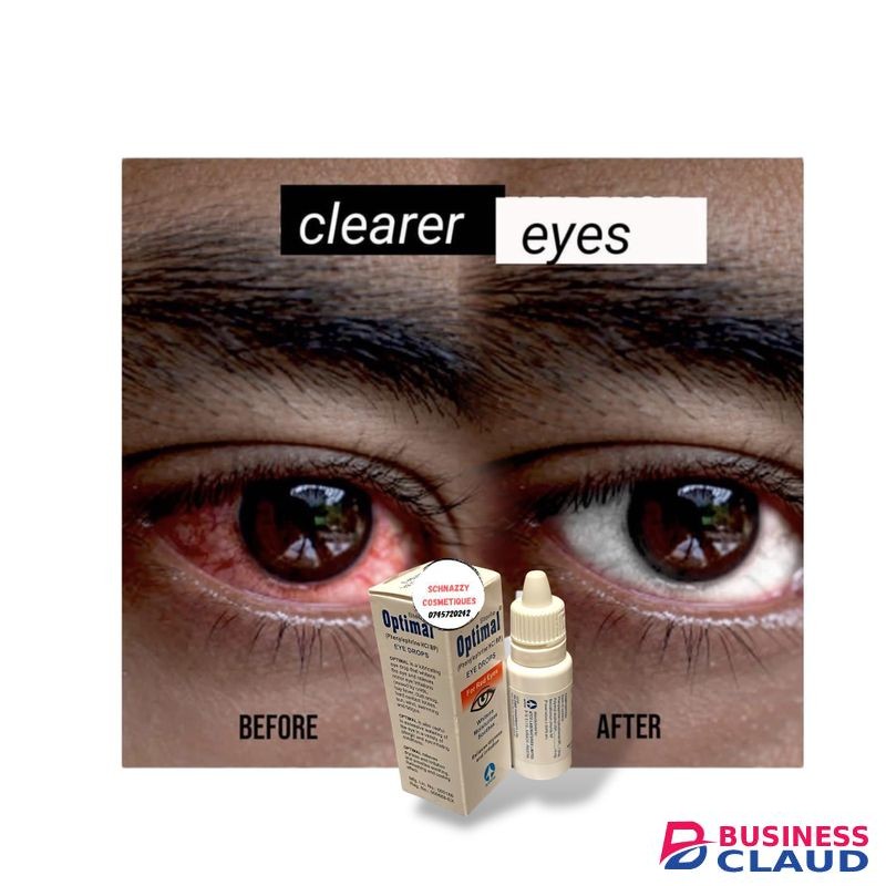 Eye Whitening Eyedrops for Red Eyes Relieves Dryness Irritation Sensitivity to Dust Light Exhaustion Whitens Moisturises Soothes Brighter Clear Eyes in Seconds