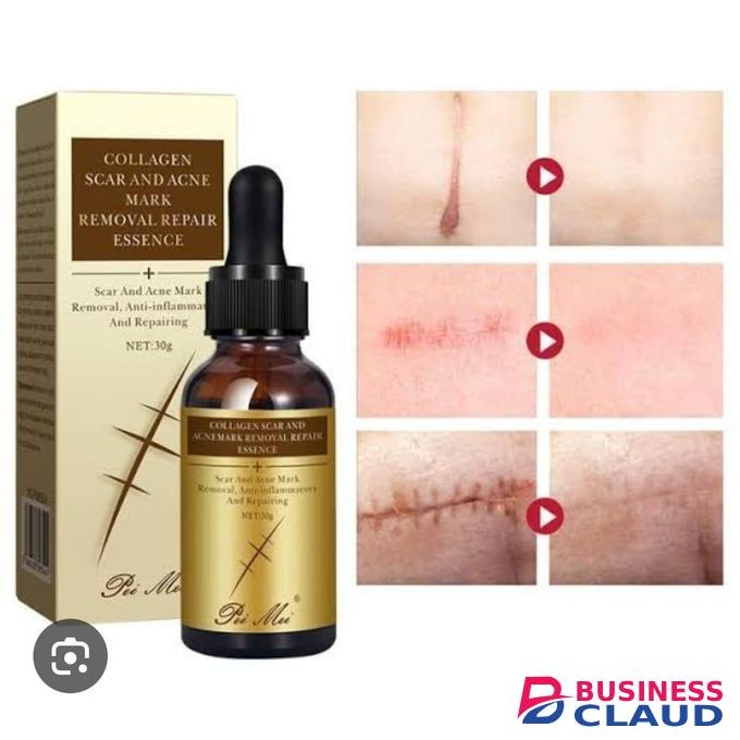 Pei Mei Scar And Acne Remover Serum