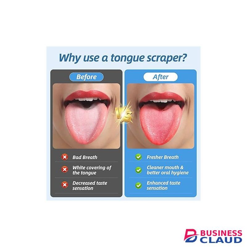 3PCS/Set Tongue Scraper Stainless Steel Oral Tongue Cleaner