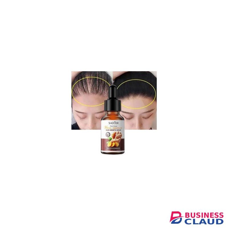 SADOER Anti Hair Loss Serum, Hair Growth Serum 30ML