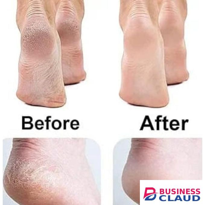 Finishing Touch Flawless Pedi Electronic Tool File and Callus Remover, Pedicure Tool-New Version