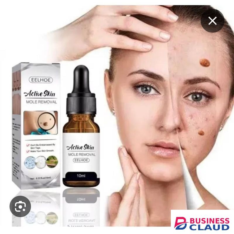 Kanza Wart Treatment Wart Removal Essence Neck Skin Tag Armpit Flat Wart Genitals Wart Feet Corns Medical Wart Liquid