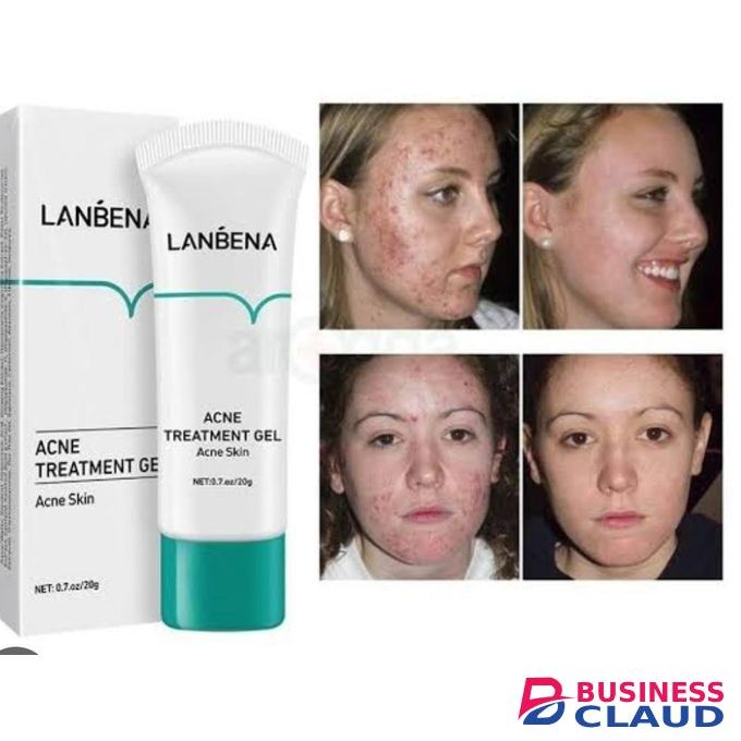 Acne Treatment Gel 20g
