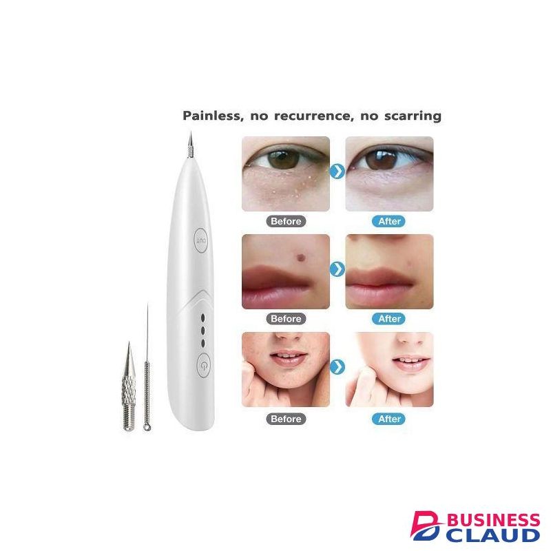 Skin Tag Removal Pen Laser Face Pimples Acne Black Dot Papilloma Warts Mole Tattoo Remover Plasma Pen Home Use Beauty Devices