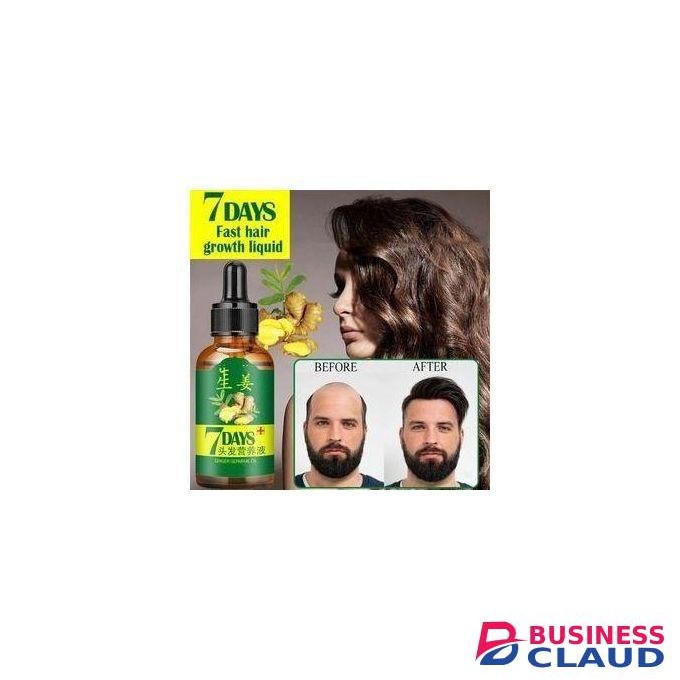 Aichun Beauty King Of Ginger 7 Days Hair Tonic,hair Growth Oil - 30ml