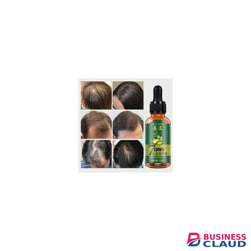 Aichun Beauty Hair Growth For Men&Women- 7days Tonic Ginger Germinal Oil