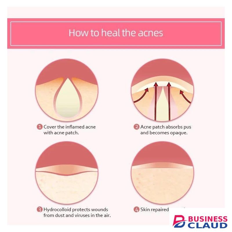 36 Patches Acne Pimple Patch Invisible Acne Removal Stickers Spot Pimple Treatment