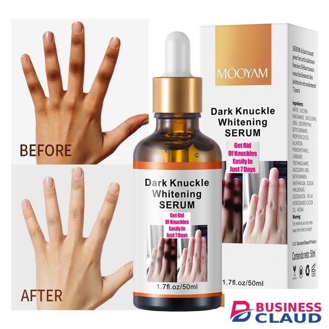 MOOYAM Knuckles Remover Serum Dark Spot Corrector Serum Elbows Knees.