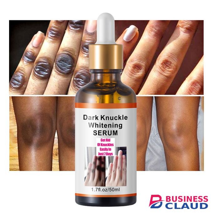 MOOYAM Knuckles Remover Serum Dark Spot Corrector Serum Elbows Knees.