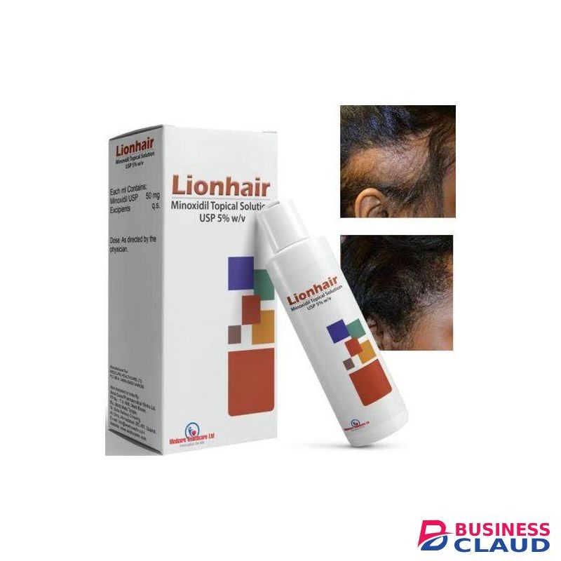 Minoxidil Lionhair Topical Solution For Alopecia,balding And Hair Thinning.