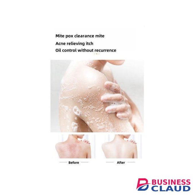 ANTI WRINKLE SKIN REJUVENATION ACNE TREATEMENT FACE AND BODY SOAP