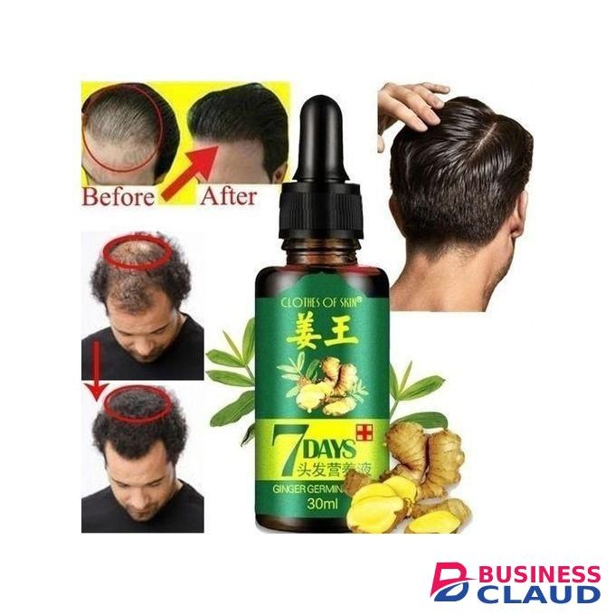 7 Day Clothes Of Skin Hair Growth Oil Promote Growth Hair Loss Treatment Oil