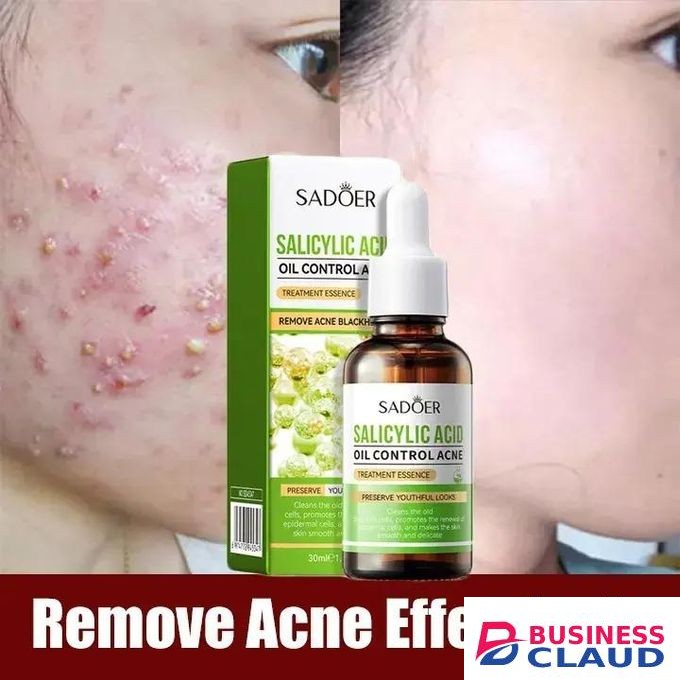 Salicylic Acid Acne Treatment Serum, Shrink Pores, Oil Control, Gentle Exfoliating, Salicylic Acid for Anti Acne, Pimple, Spot, Blackhead Salicylic Acid Essence_30ml