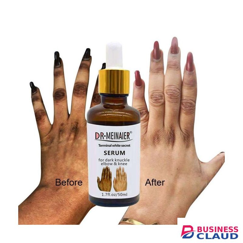 DR MEINAIER Whitening Serum Removes Dark Knuckles, Elbows, Armpits, Knees