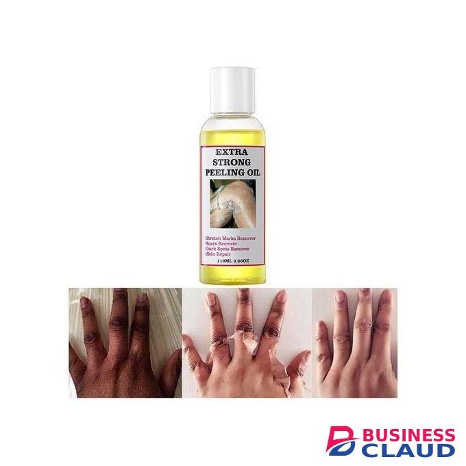Extra Strong Peeling Oil Elbows Knees Hands Even Complexion