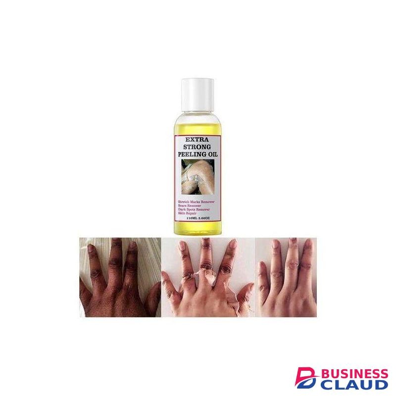 Extra Strong Peeling Oil Elbows Knees Hands Even Complexion
