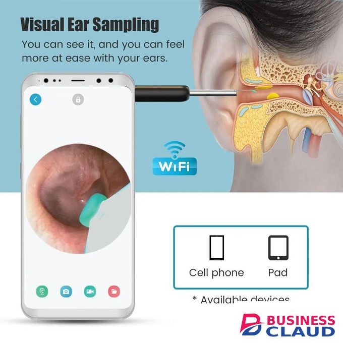 Ne Rechargeable Wireless Smart Ear Cleaner Wax Removal Device with Ear Endoscope Buds Picker NE16 White