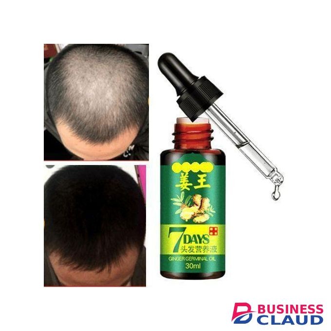 Aichun Beauty Days Hair Tonic Ginger Germinal Regrowth Oil