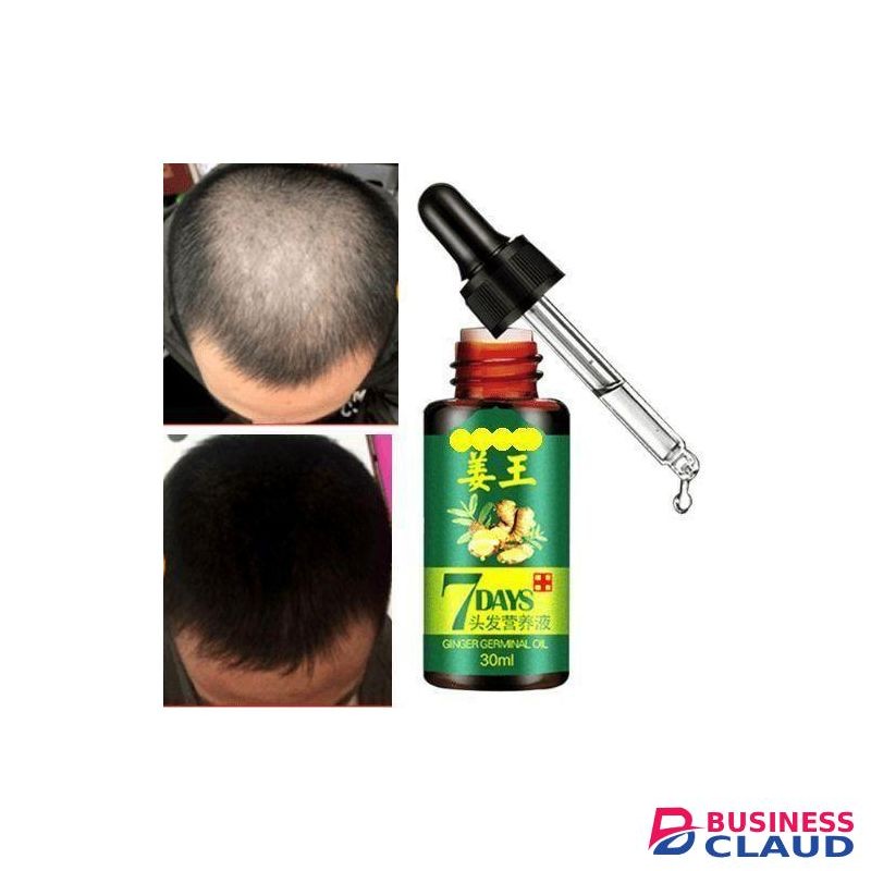 Aichun Beauty Days Hair Tonic Ginger Germinal Regrowth Oil