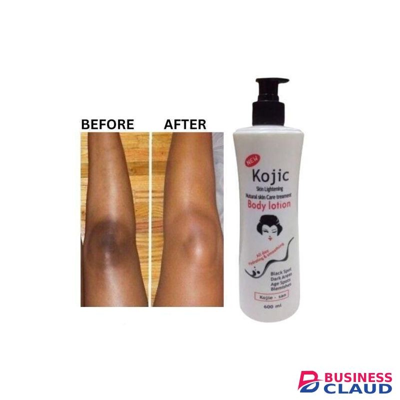 Kojie San Kojic Moisturizing Body Lotion 600ml