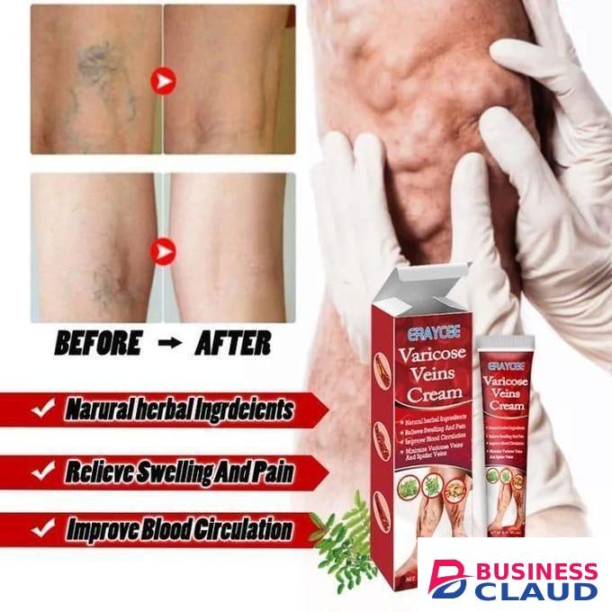 ERAYCEE Varicose Vein Cream - Spider Vein Treatment, Leg Circulation & Pain Relief, Skin Firming