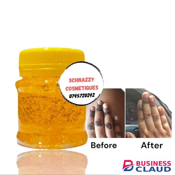 Beauty Stubborn Dark Knuckles Gel Hyperpigmentation Discoloration Fades Blackish Marks (Not for Face) Elbows Knees Hands Toes Feet Armpits Dark Inner Thighs KENNITE