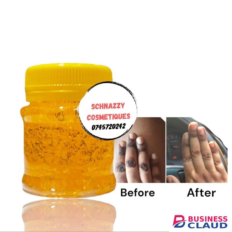 Beauty Stubborn Dark Knuckles Gel Hyperpigmentation Discoloration Fades Blackish Marks (Not for Face) Elbows Knees Hands Toes Feet Armpits Dark Inner Thighs KENNITE