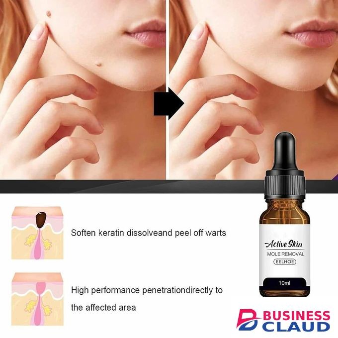 Eelhoe ADVANCED MOLE AND WART ESSENCE – SKIN FACE ARMPIT MEAT NECK REMOVAL REPAIR CLEANSING CARE (10ml)