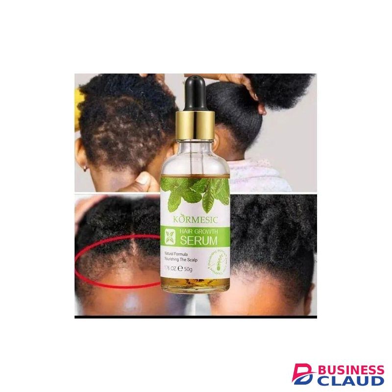 KORMESIC Hair Growth Serum