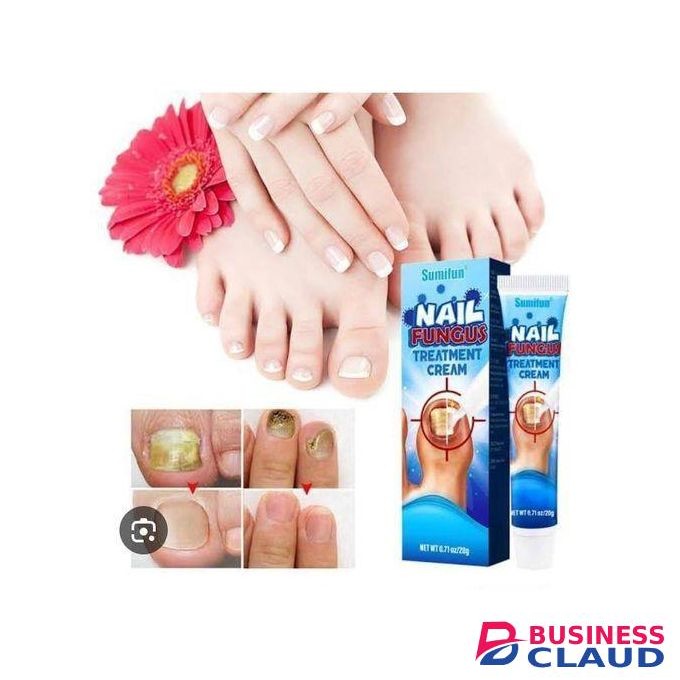 Sumifun Nail Fungus Treatment Cream – Repairs, Restores & Protects Damaged Nails