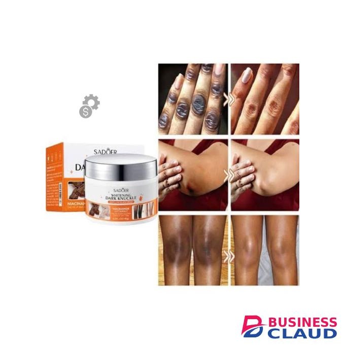 SADOER ntensive Knuckle Whitening Cream to Fade Dark Spots and Improve Skin Texture