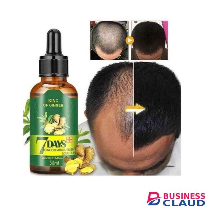 Aichun Beauty King Of Ginger 7 Days Hair Tonic ,hair Growth Oil