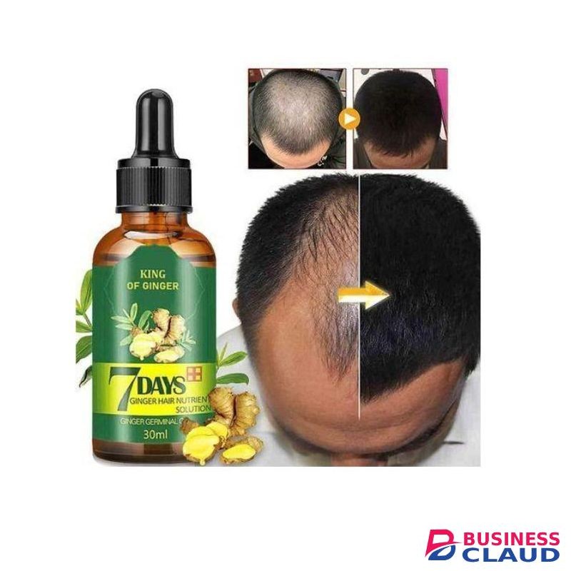 Aichun Beauty King Of Ginger 7 Days Hair Tonic ,hair Growth Oil