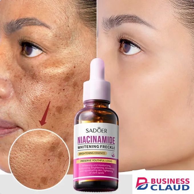 Niacinamide Whitening Dark spots Brightening Melasma Pigmentation Remover Essence