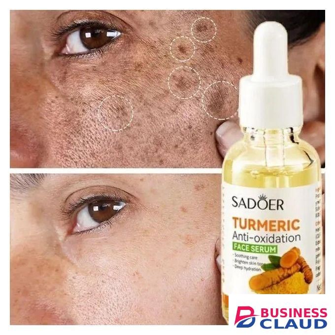 Dark Spot Remover Tumeric Serum, Anti-Oxidation Face Serum Oil Control Acne Remover Even Skin Tones, Improving Skin Tone Brightening Serum - Moisturizing Anti-Aging