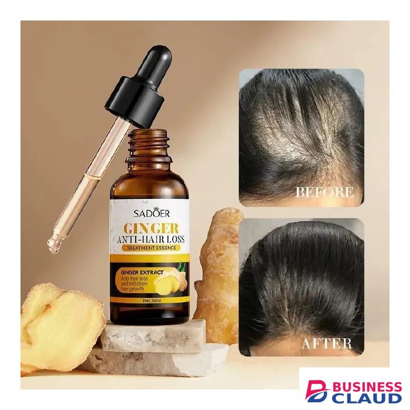 SADOER Anti Hair Loss Treatment Essence, Hair Growth Ginger Extract Beard Growth,Hair Growth, Anti Dandruffs Hair Moisturizing Hair Care Serum, Derma Roller compliment in Anti Hair Loss